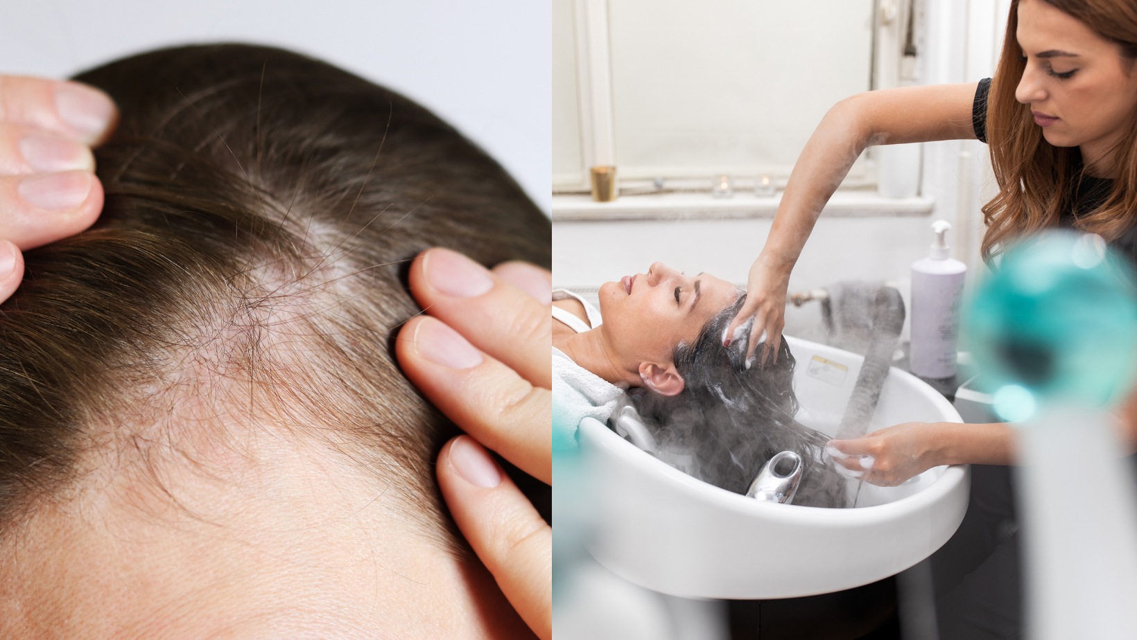 Plaukų stilistė: „Moterys ateina su ta pačia problema. Ir kiekvienai sakau tą patį – šampūnas jūsų neišgelbės.“