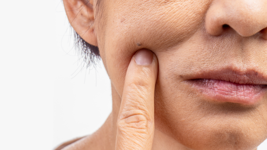 Specialistai perspėja: jei jūs darote šias klaidas, net ir brangiausios grožio procedūros tampa bevertės